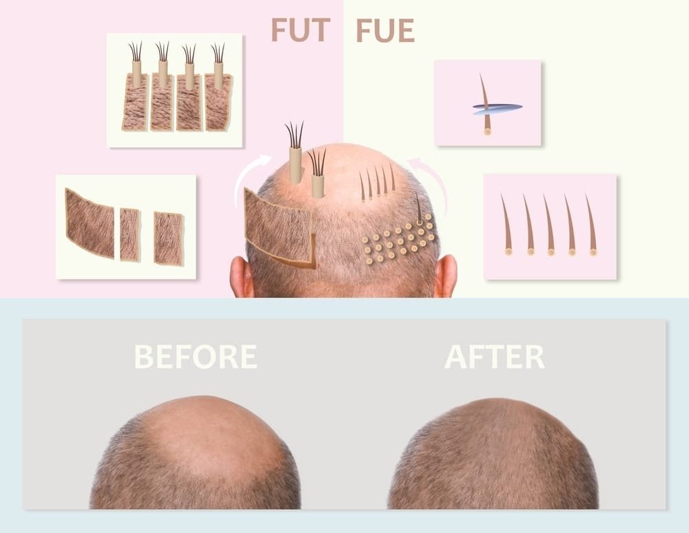fue-sac-ekimi