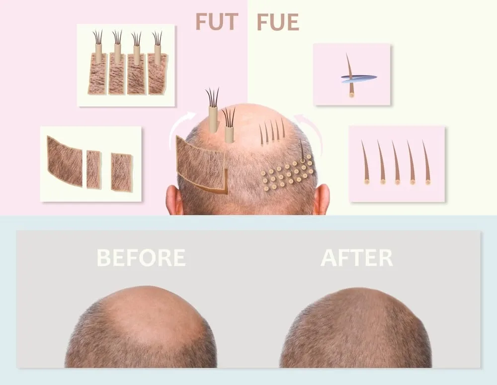 fue-sac-ekimi
